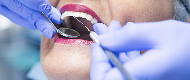 Best Urgent Care for Lost Fillings or Crowns in Roanoke, VA